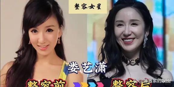 被整容毁了的14位女星，出道时貌美如花，如今灵气全无