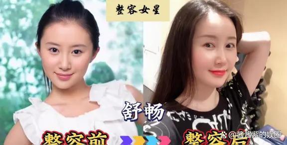 被整容毁了的14位女星，出道时貌美如花，如今灵气全无