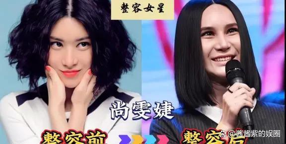 被整容毁了的14位女星，出道时貌美如花，如今灵气全无