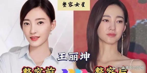 被整容毁了的14位女星，出道时貌美如花，如今灵气全无