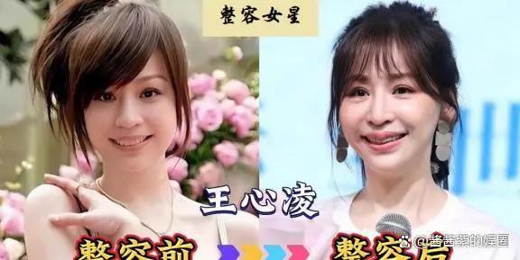 被整容毁了的14位女星，出道时貌美如花，如今灵气全无
