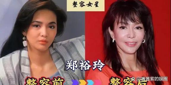 被整容毁了的14位女星，出道时貌美如花，如今灵气全无