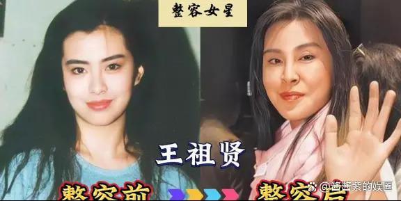 被整容毁了的14位女星，出道时貌美如花，如今灵气全无