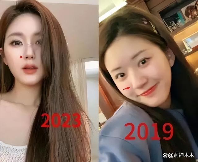 赵露思近照引发围观，嘴唇怪异妆容油腻被网友吐槽