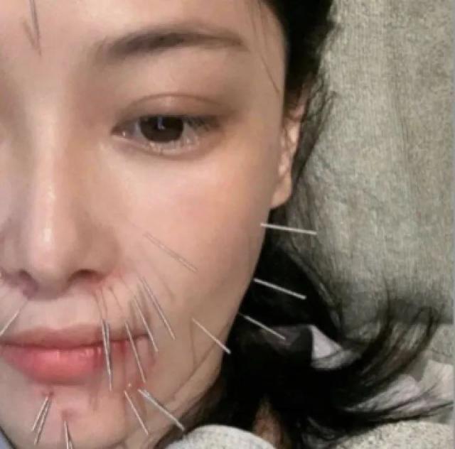 知名女星晒照引热议！脸上密密麻麻…