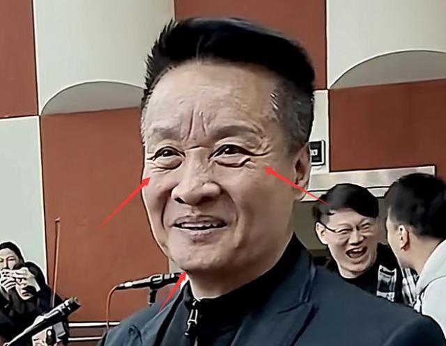 66岁阎维文近照曝光变化巨大，为照顾患癌妻子苍老太多