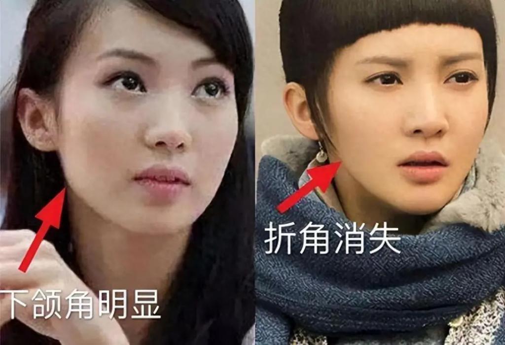 有种顽强叫“我没整容”！明明从大饼脸变成V脸，当观众看不见