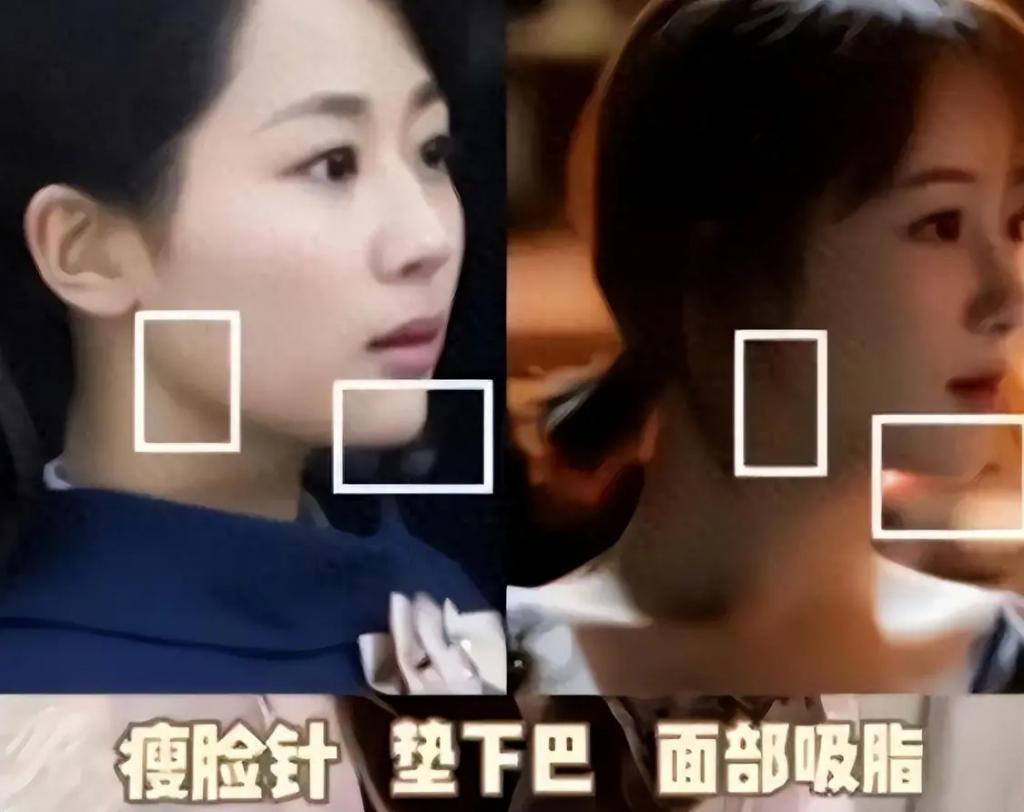 有种顽强叫“我没整容”！明明从大饼脸变成V脸，当观众看不见