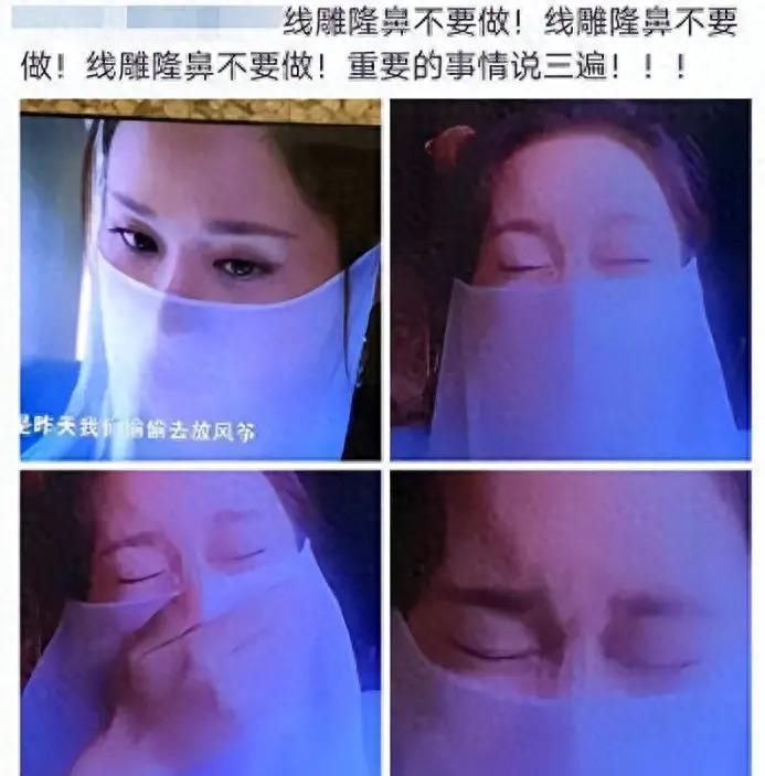 有种顽强叫“我没整容”！明明从大饼脸变成V脸，当观众看不见