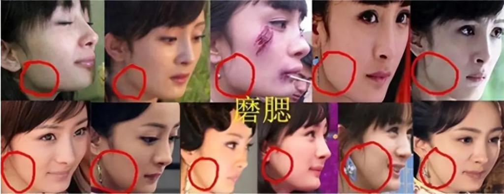 有种顽强叫“我没整容”！明明从大饼脸变成V脸，当观众看不见