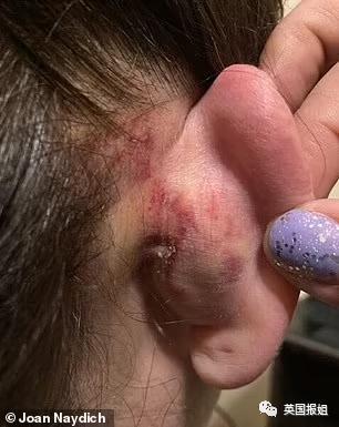 17岁男生将老师打成残废！母亲为他求情惹怒全网：孩子不懂事求放过！