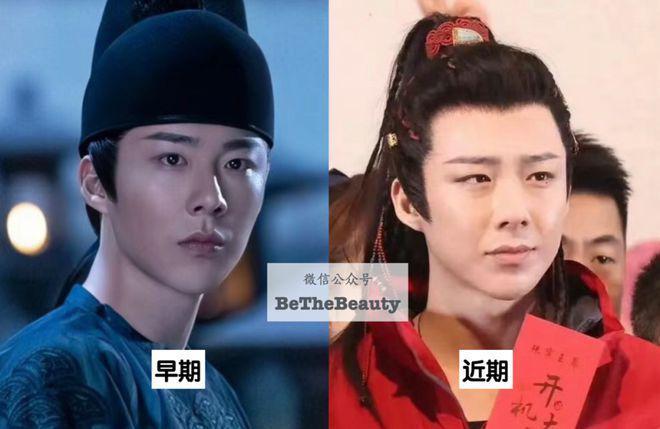 性张力vs性缩力：到底差在哪？