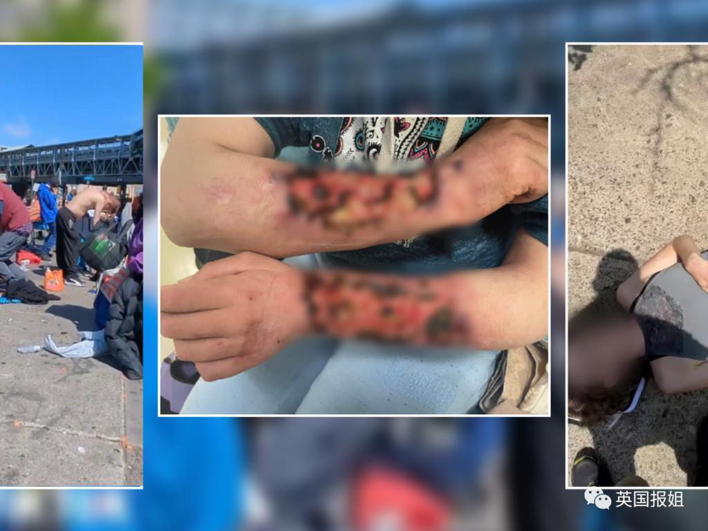 美国“僵尸城”成网红打卡点?瘾君子街头痛苦挣扎状如僵尸,诡异姿态全网疯传!