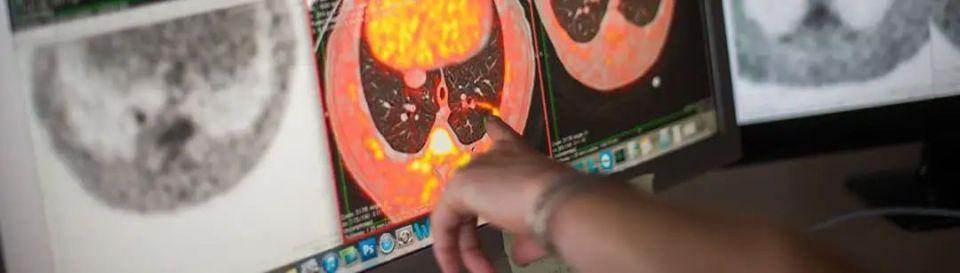 比尔·盖茨年度展望：未来之路将在2024年迎来转折点