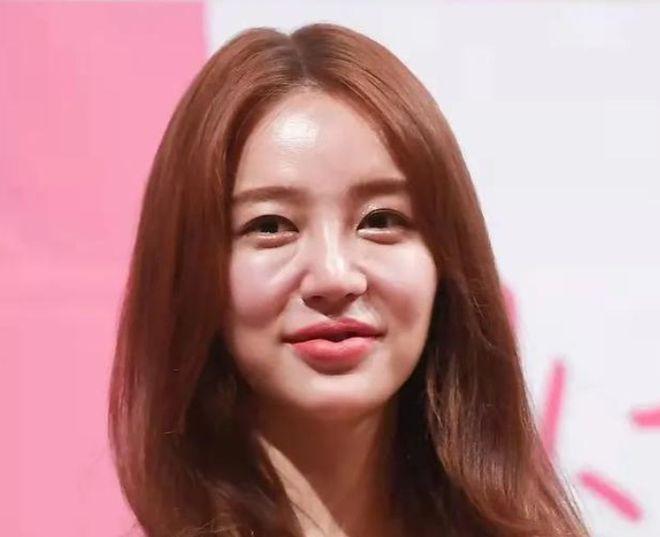39岁尹恩惠晒穿搭日常：短发眼镜显俏皮，皮肤白皙状态佳