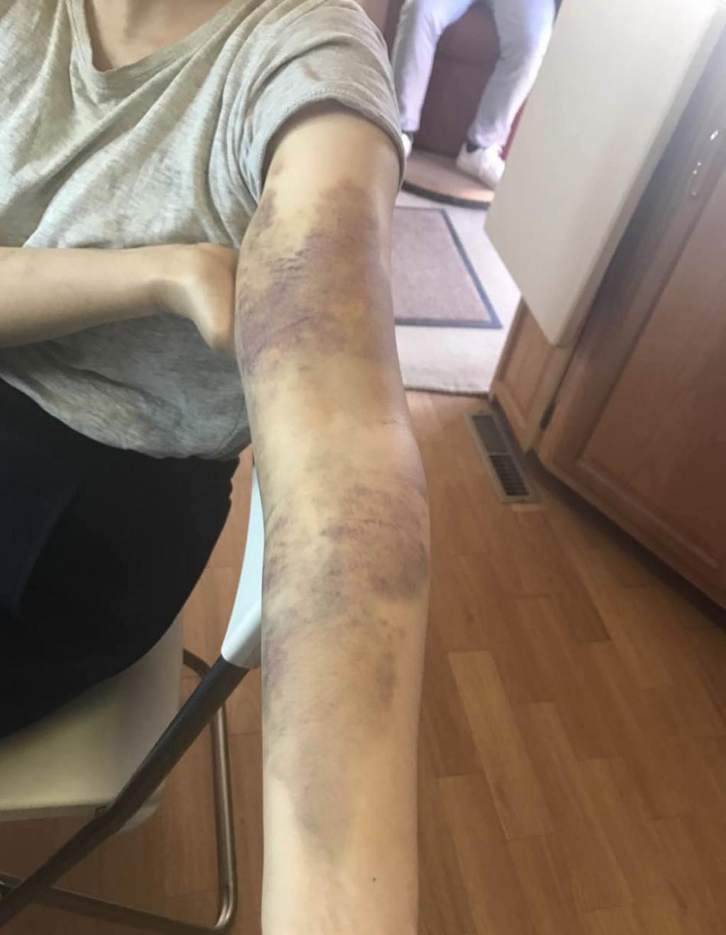 自嘲“我就是一只疯狗。”她是疯，还是痴？