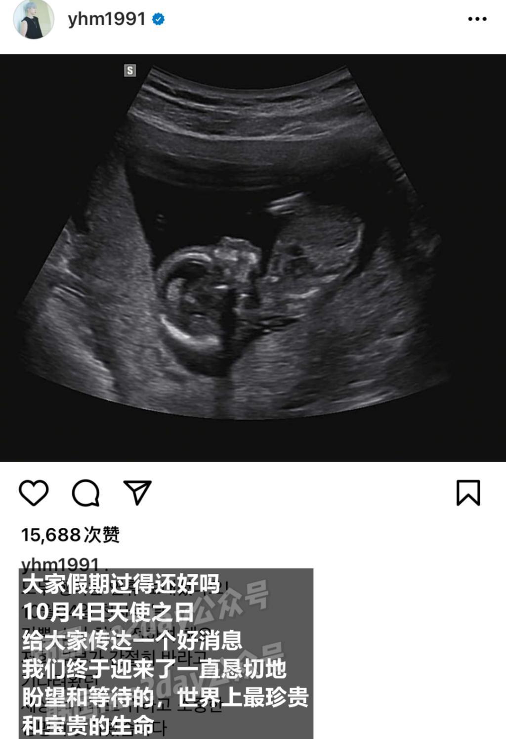 恭喜这对爱豆夫妇结婚一年喜得贵子！