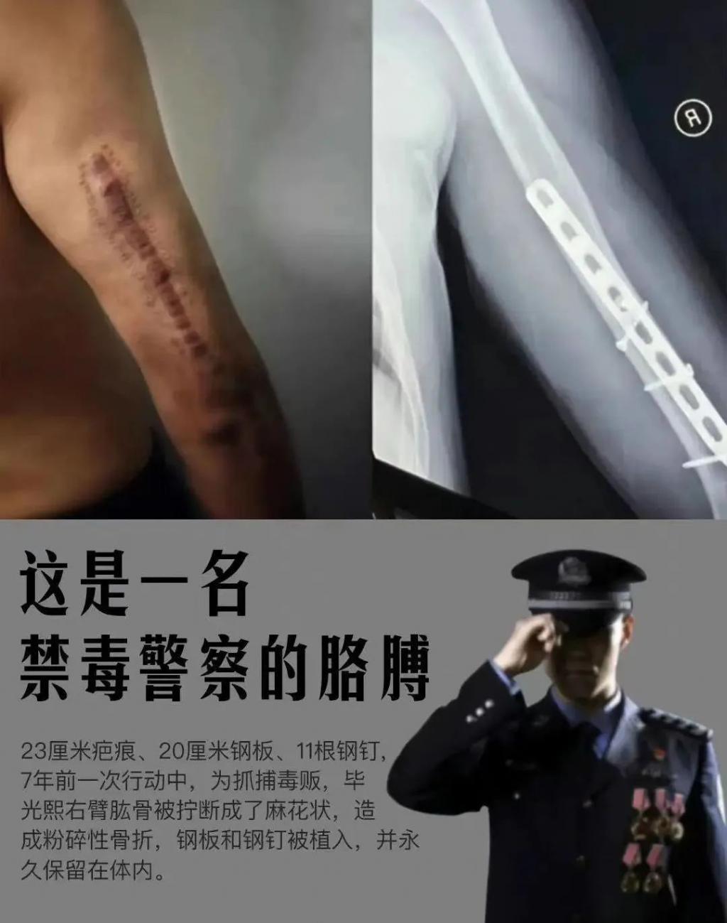 吸毒艺人复出拿影帝?这是今年最大的笑话