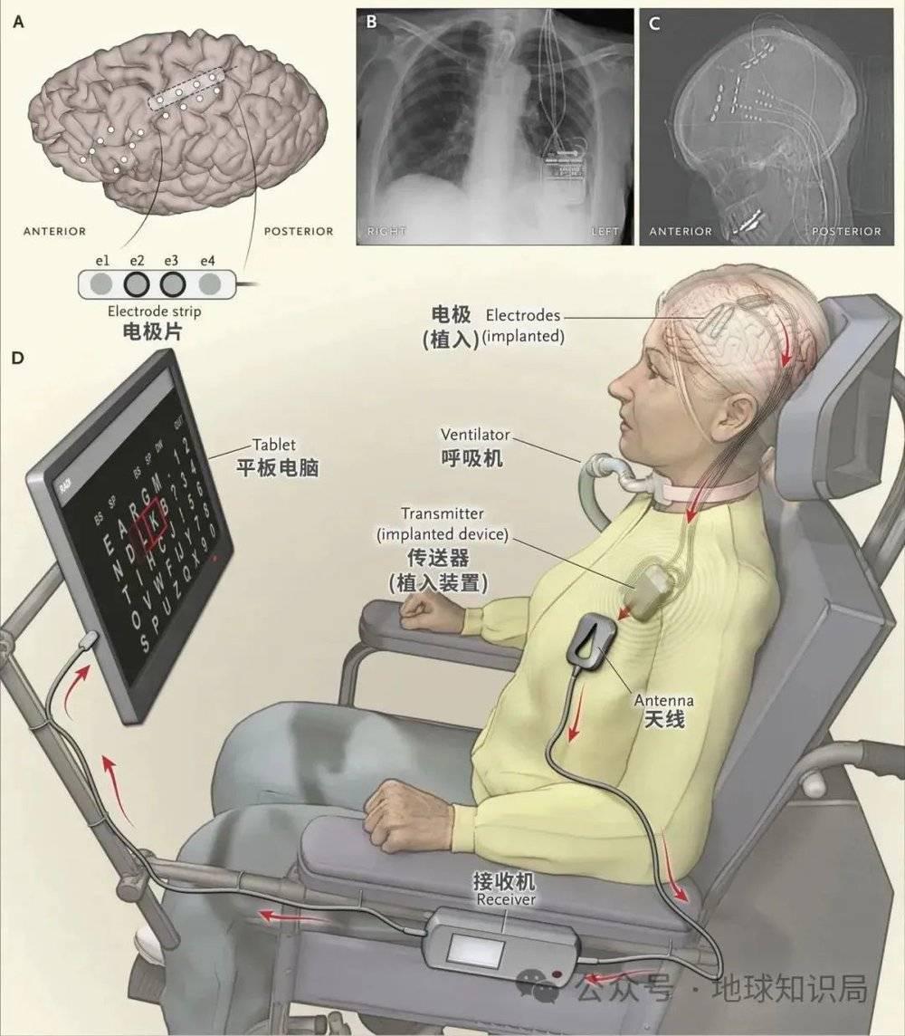 美国最新技术来了，专搞人的脑子