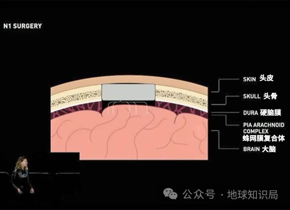 美国最新技术来了，专搞人的脑子