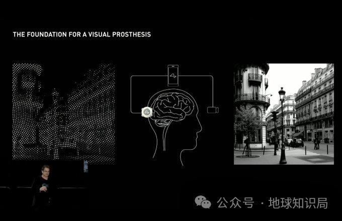 美国最新技术来了，专搞人的脑子