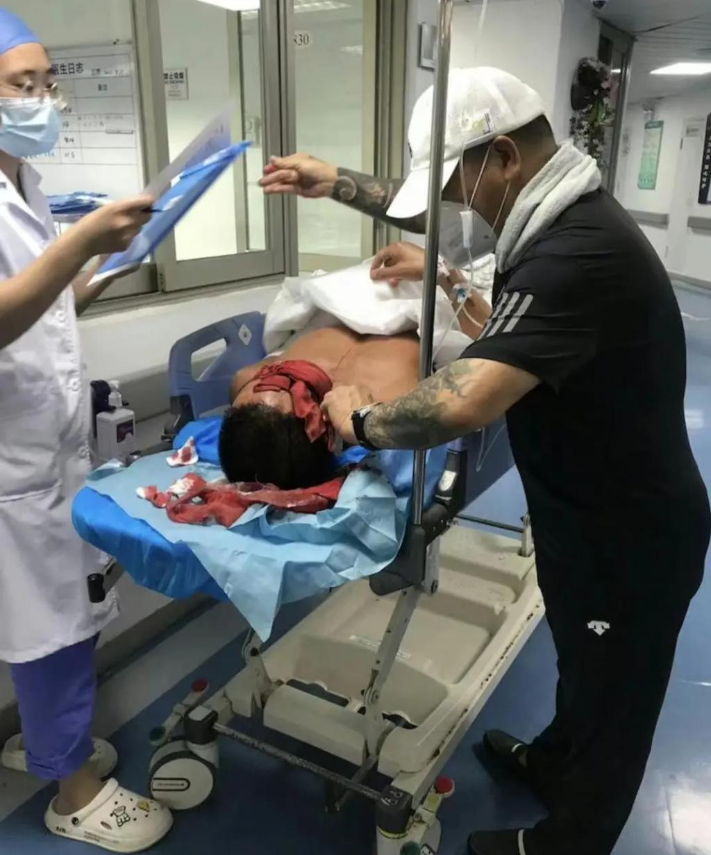 港星黄竣锋被砍案结果公布，凶徒被判10年，动机曝光