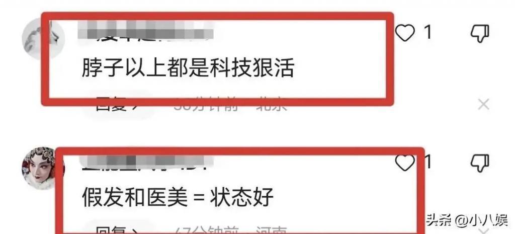 62岁蔡明近照引争议！亮相保定菜市场，嘴巴鼻子好僵硬