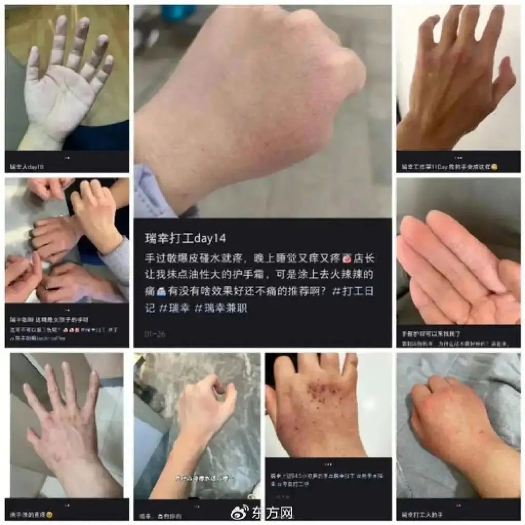 “在瑞幸烂掉的手，亲妈看了都摇头”