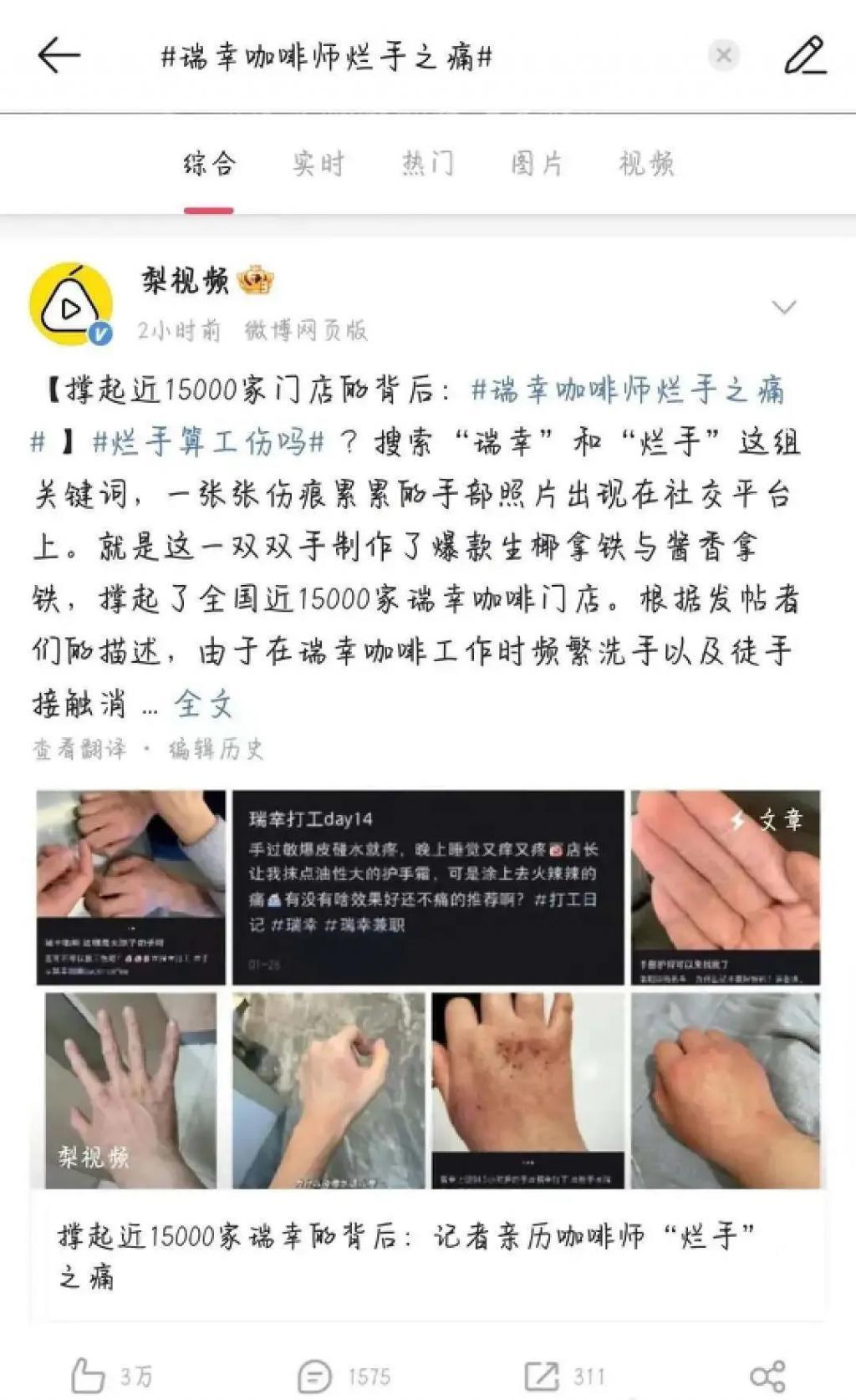 “在瑞幸烂掉的手，亲妈看了都摇头”