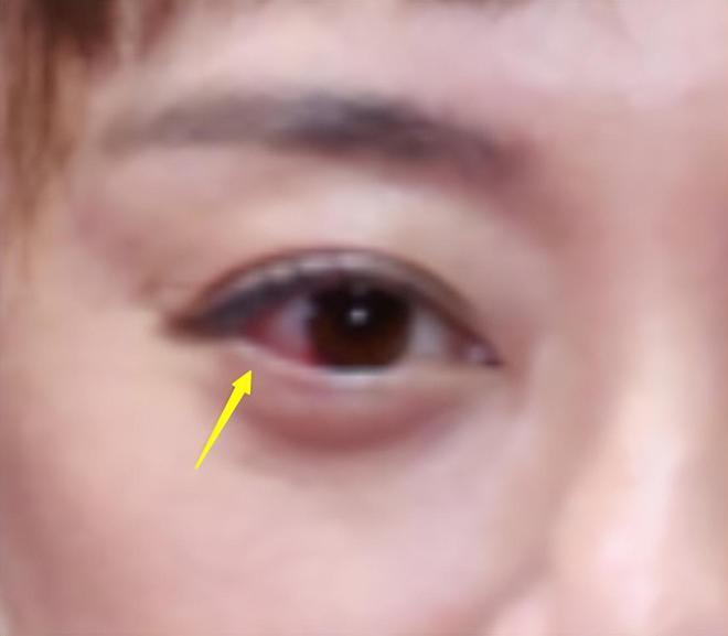 红毯这一夜，杨幂的脸孙俪的眼，撕开女星遮羞布