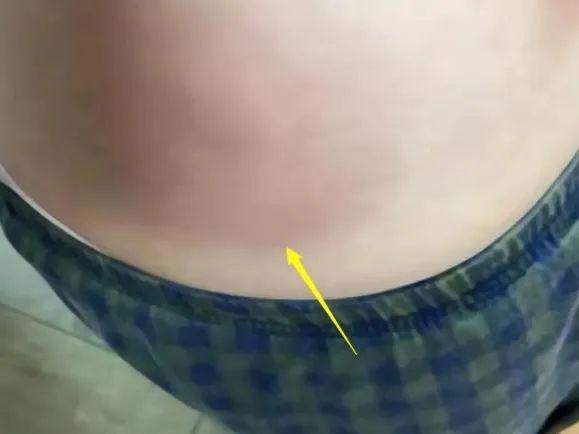 爷孙恋又出事了！女主遇袭后身份曝光：竟是富二代