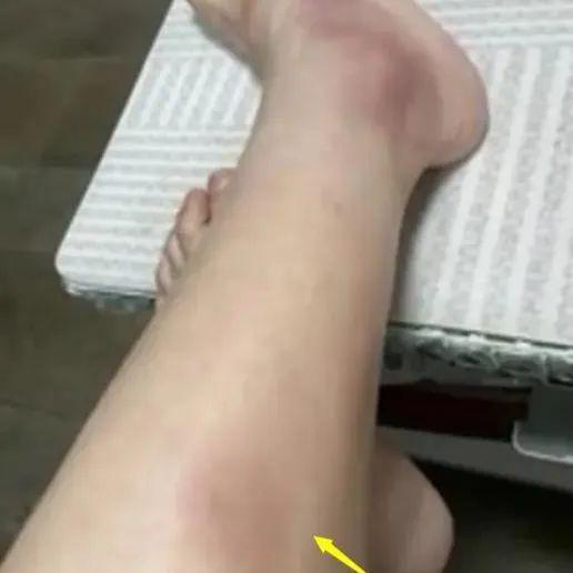 爷孙恋又出事了！女主遇袭后身份曝光：竟是富二代