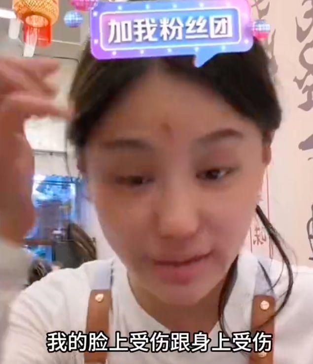 樊小慧被前婆婆上门暴打并索赔！伤势严重，前夫袖手旁观