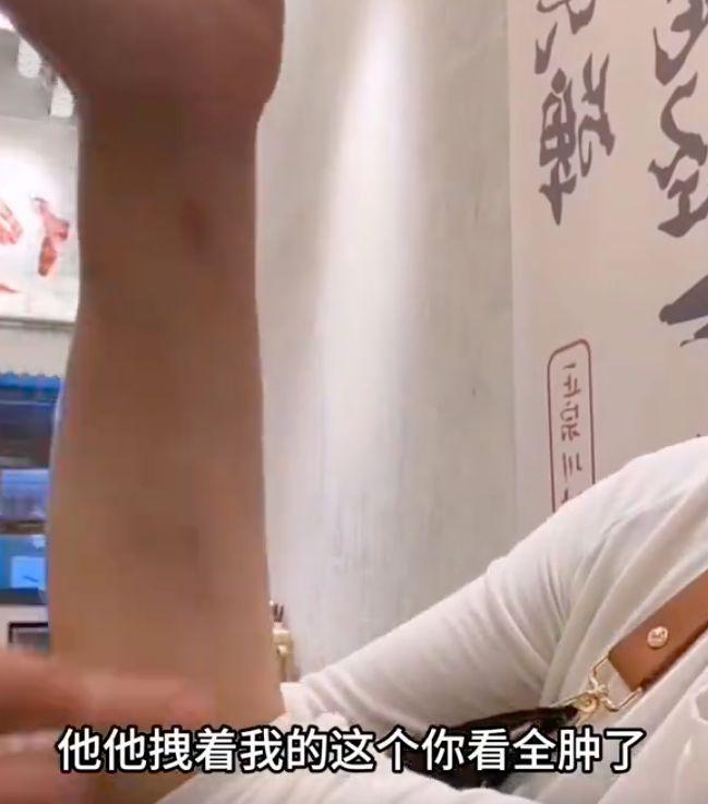 樊小慧被前婆婆上门暴打并索赔！伤势严重，前夫袖手旁观