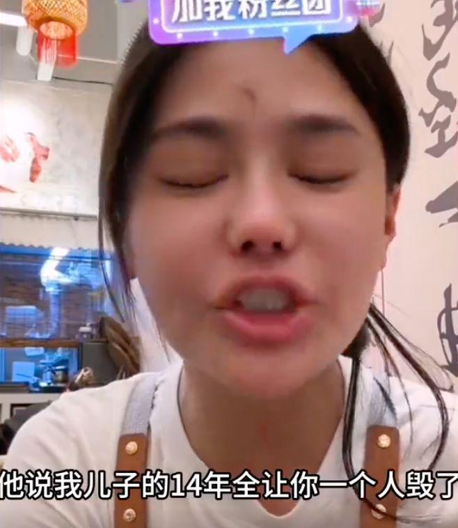 樊小慧被前婆婆上门暴打并索赔！伤势严重，前夫袖手旁观