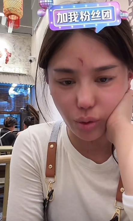 千万网红樊小慧被封号！自曝被婆婆殴打，网友发现3点疑点