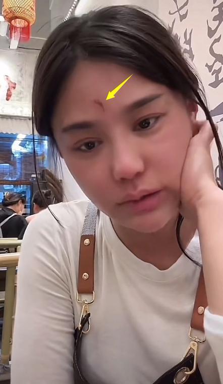 千万网红樊小慧被封号！自曝被婆婆殴打，网友发现3点疑点