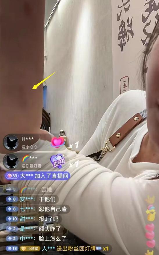 千万网红樊小慧被封号！自曝被婆婆殴打，网友发现3点疑点