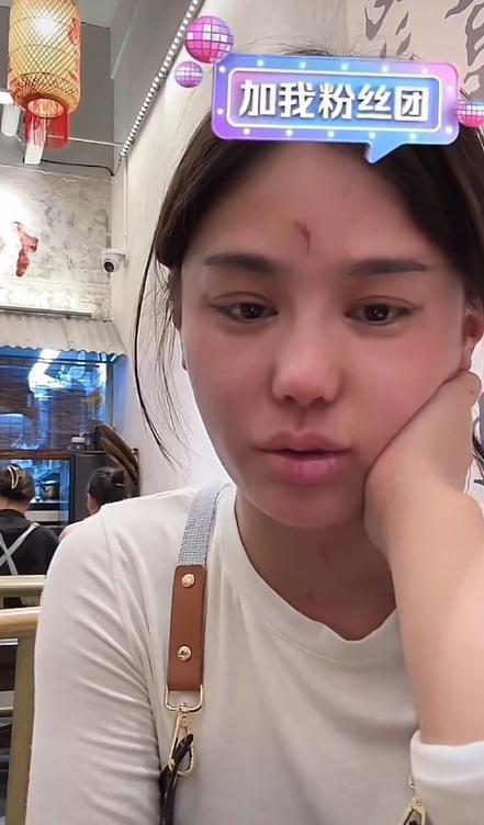 千万网红樊小慧被封号！自曝被婆婆殴打，网友发现3点疑点