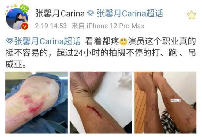 林峰受伤！拄拐现身曝受伤原因，吴千语施伯雄新疆秀恩爱
