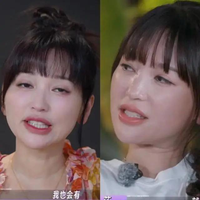 金莎劝大家谨慎打玻尿酸因为会干涉表情，朱丹表情太真实