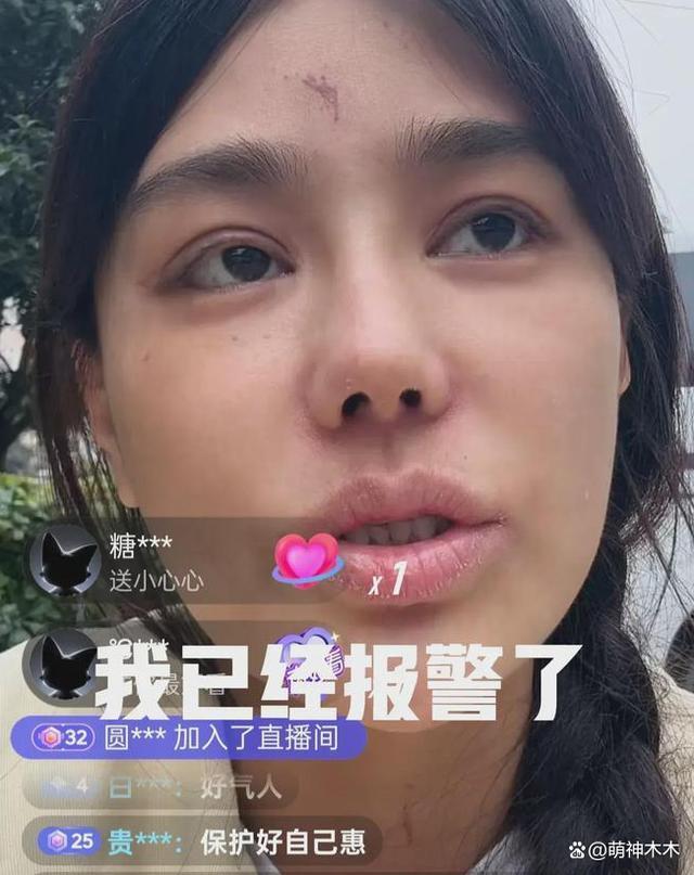 网红樊小慧被打后续：警方已介入调查，本人否认是炒作