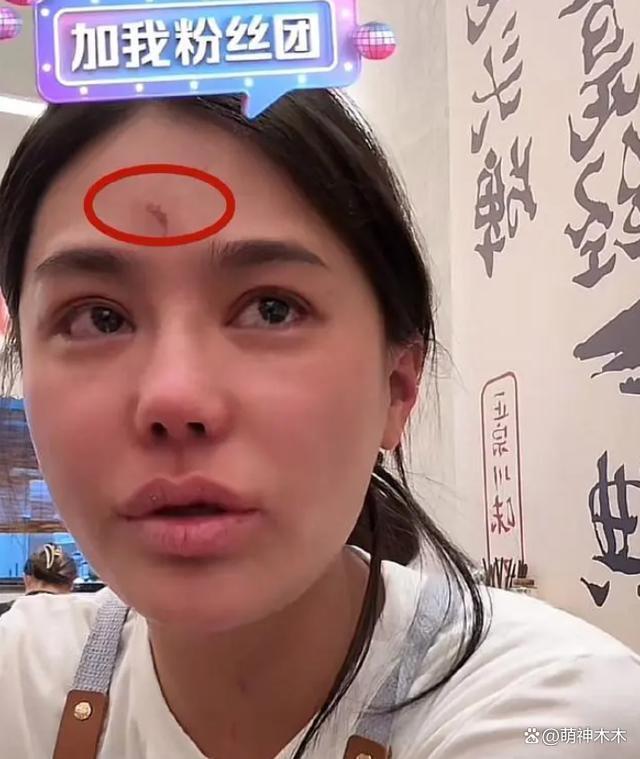 网红樊小慧被打后续：警方已介入调查，本人否认是炒作