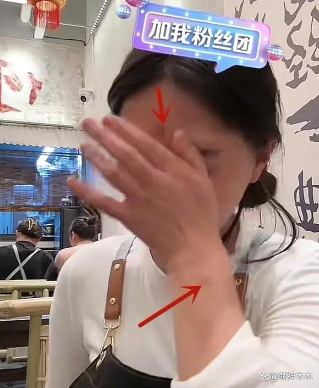 网红樊小慧被打后续：警方已介入调查，本人否认是炒作