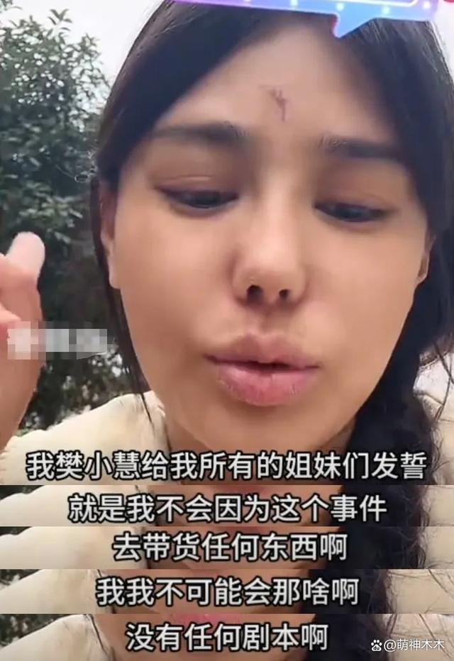 网红樊小慧被打后续：警方已介入调查，本人否认是炒作