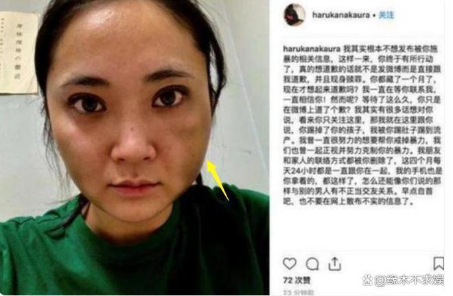 蒋劲夫6年前片酬6900万，被扒穿LV去送外卖，衣服7万多