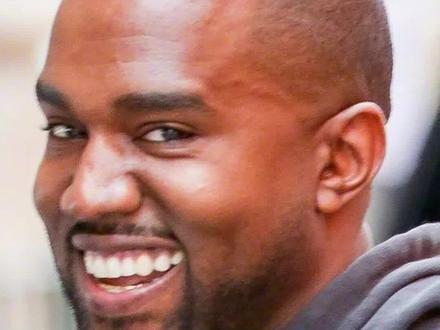 花了600w！坎爷Kanye换了一副钢牙