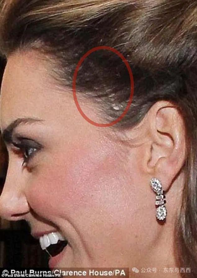 凯特王妃做大手术爆病情严重,生养三娃还瘦成纸片人太累了吗