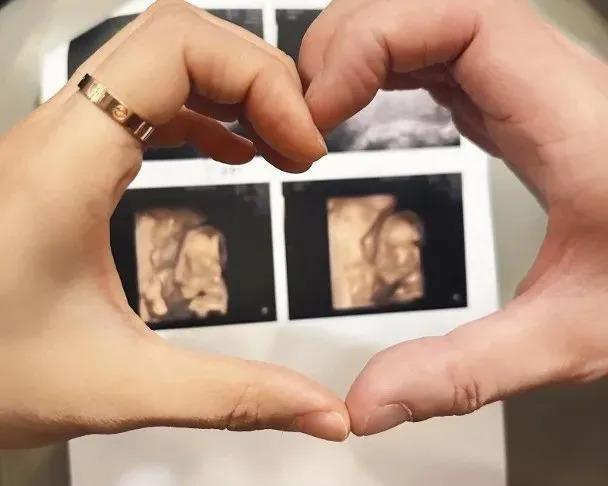 知名女星突宣布已婚生B！疫情期间秘密结婚！