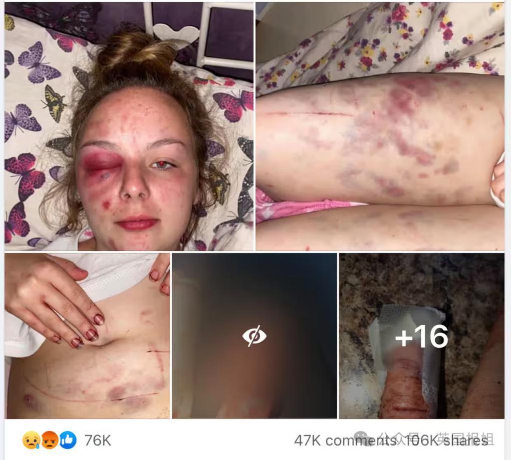 19岁女孩遭多次暴力侵犯,反被判刑8年半?真相反转震撼英国:她故意用铁锤砸自己编故事!